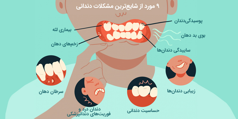 شایع-ترین-مشکلات-دندانی